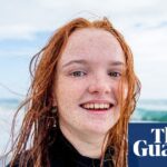 Ancient remains highlighting the genetic study on red hair and natural selection.